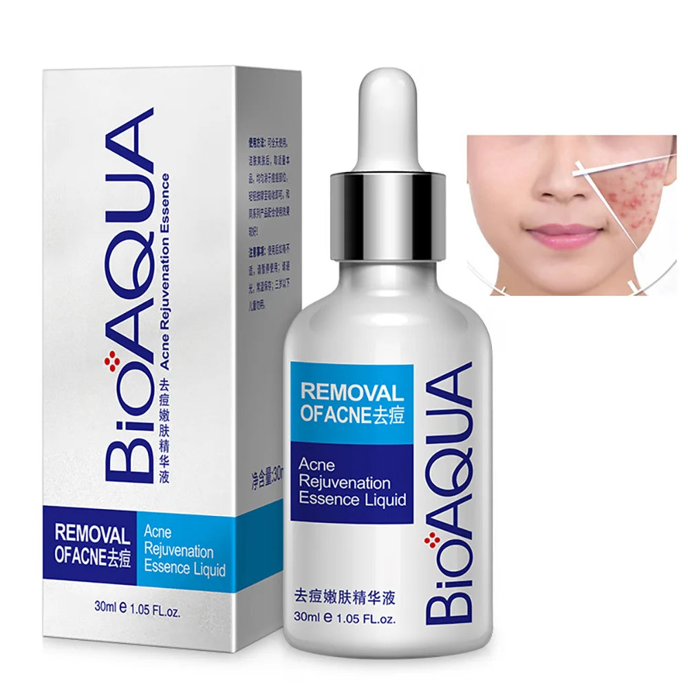 SUERO ANTI ACNE BIOAQUA | ENVÍO GRATIS